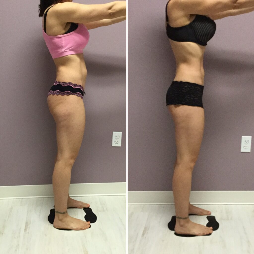 before and after 6 red light sessions